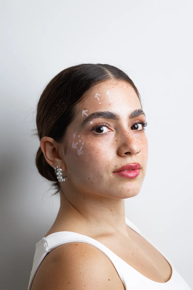 Análisis facial — medicina estética